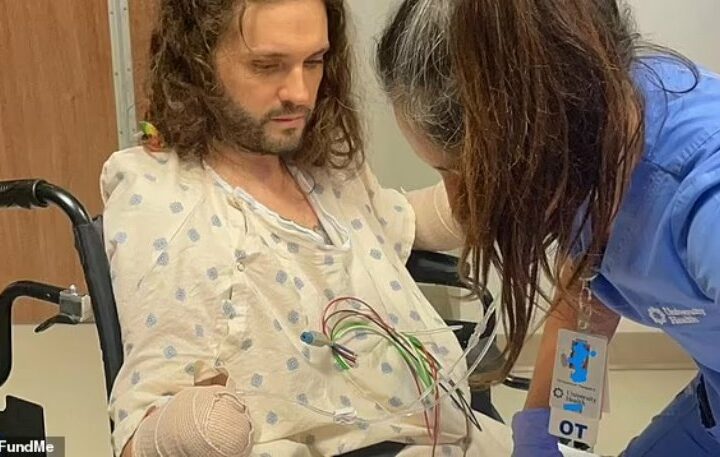 A Texas man lost his hands and feet recently after a solitary insect nibble