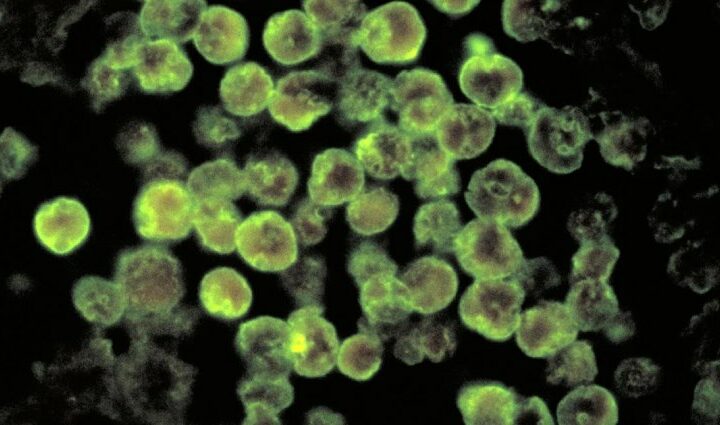 Youngster bites the dust from cerebrum eating single adaptable cell subsequent to visiting underground aquifer, Nevada authorities say