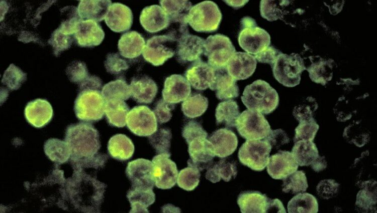 Youngster bites the dust from cerebrum eating single adaptable cell subsequent to visiting underground aquifer, Nevada authorities say