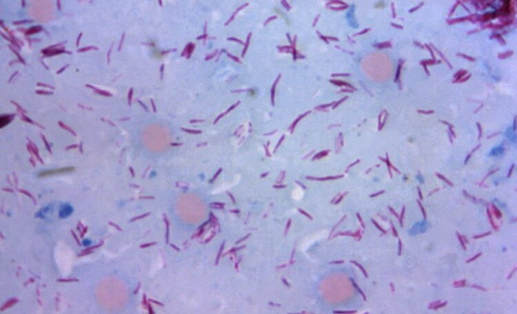 According to the report, Central Florida is a hotbed of leprosy