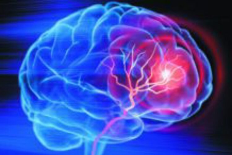 Warning: Utilization of Well known Heartburn Prescriptions Connected to 33% Higher Gamble of Dementia