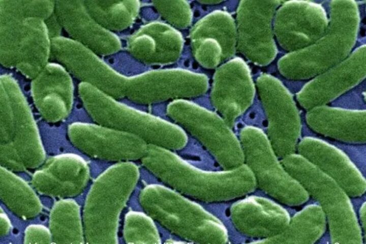 3 Kick the bucket in N.Y. Region From Disease Spread Through Seawater and Shellfish